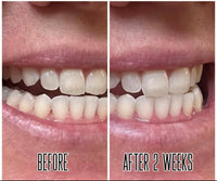 Whitening toothpaste PRE-ORDER (ships in @ 2 weeks)